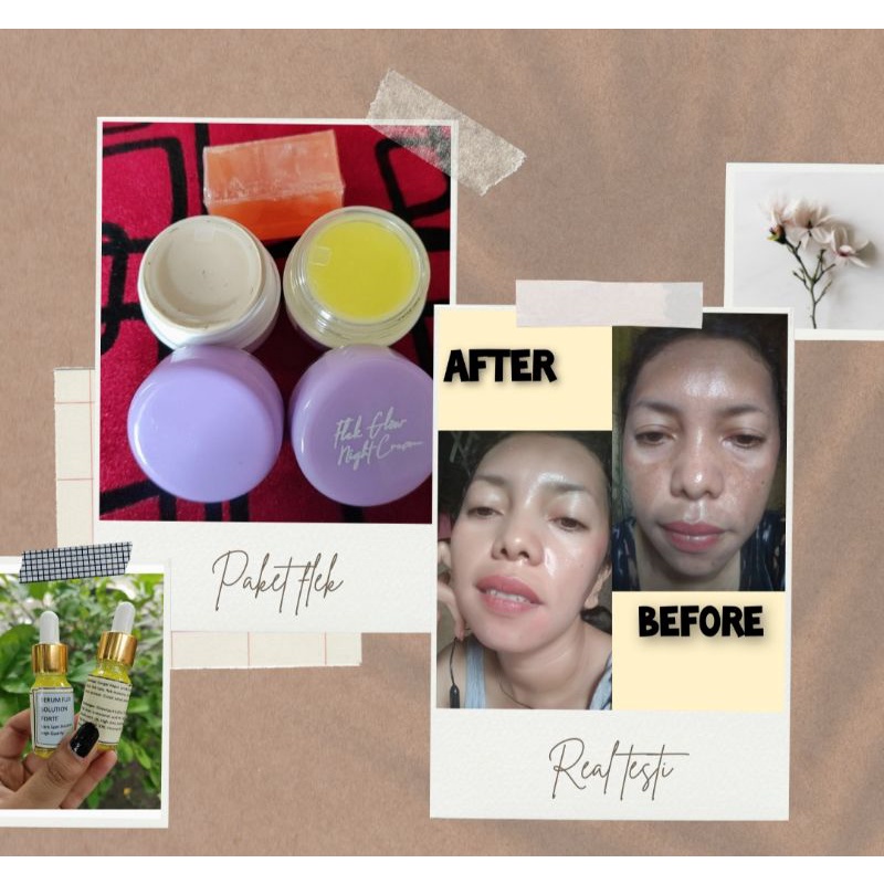 paket cream flek whitening