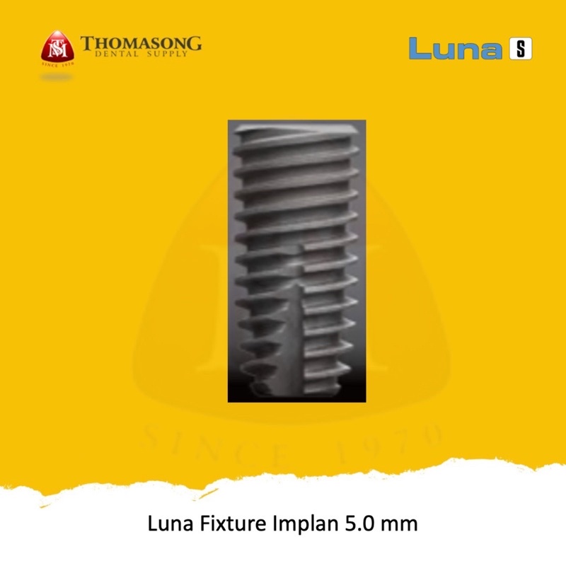 Luna Implan Fixture Diameter 5.0 mm RP