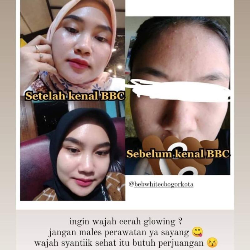 Beb White C