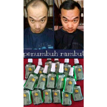 penumbuh rambut