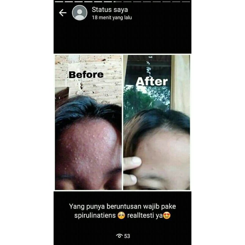 Masker