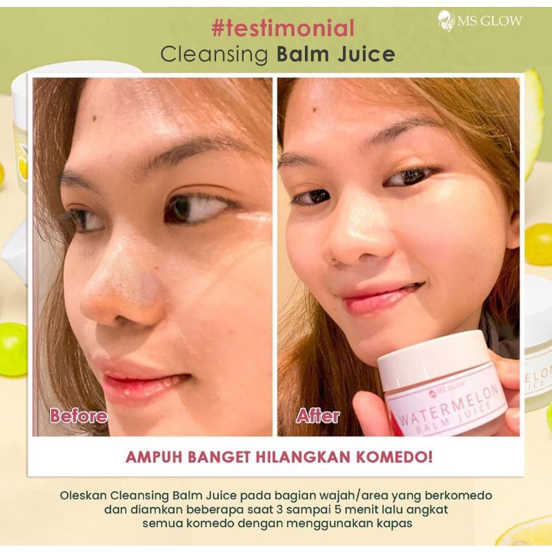 BALM JUICE BY MSGLOW