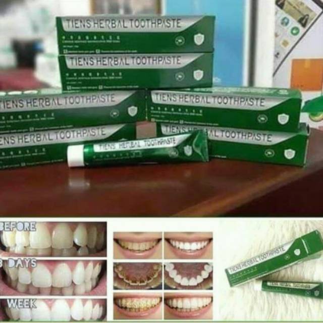 Odol Pemutih Gigi / Tooth Paste Tiens