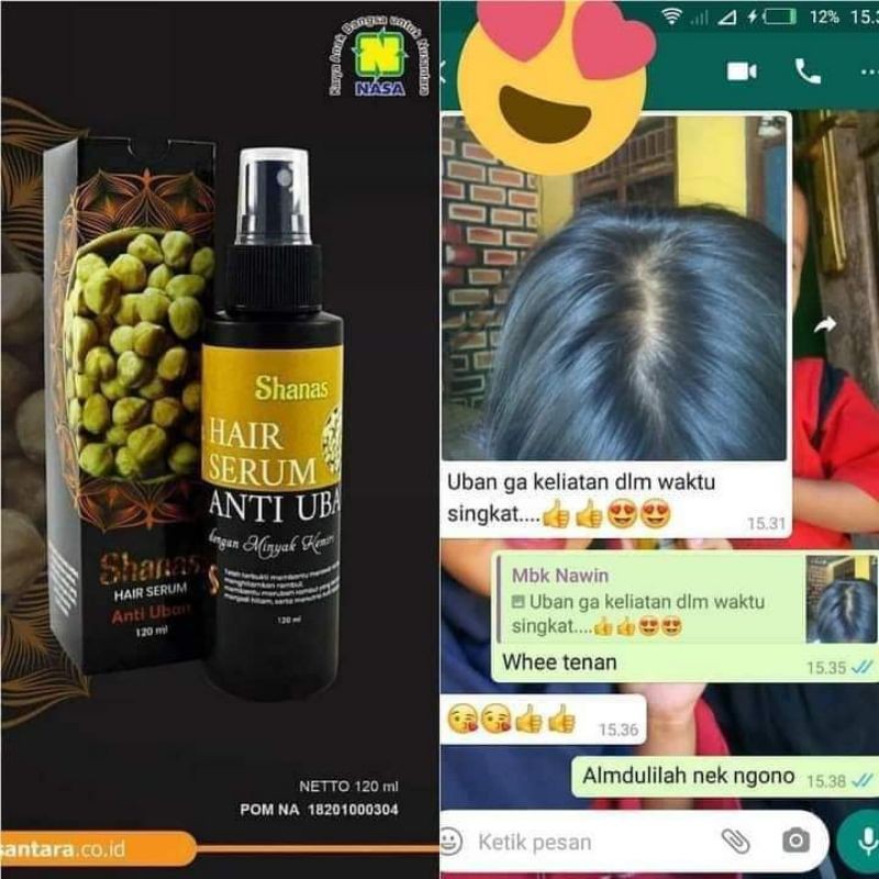 Serum Anti Uban