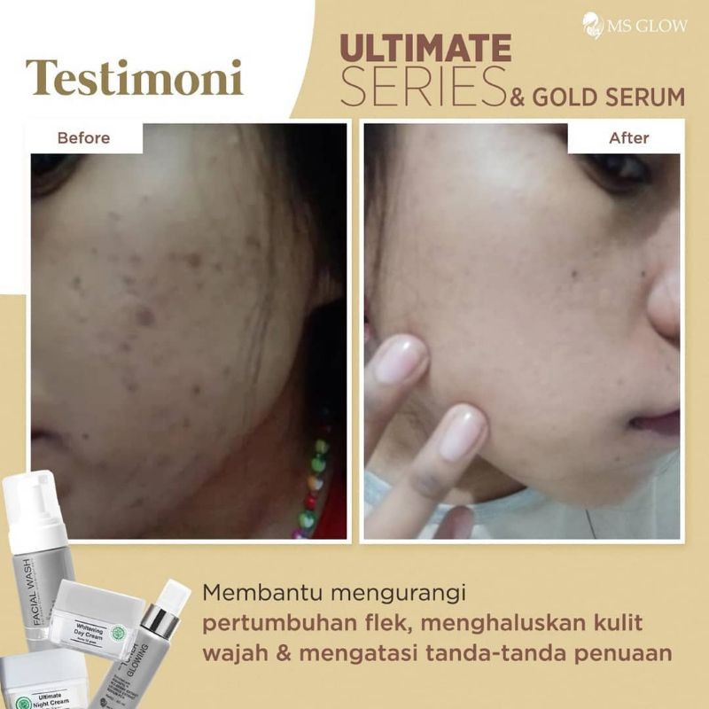 promo ms glow ultimate