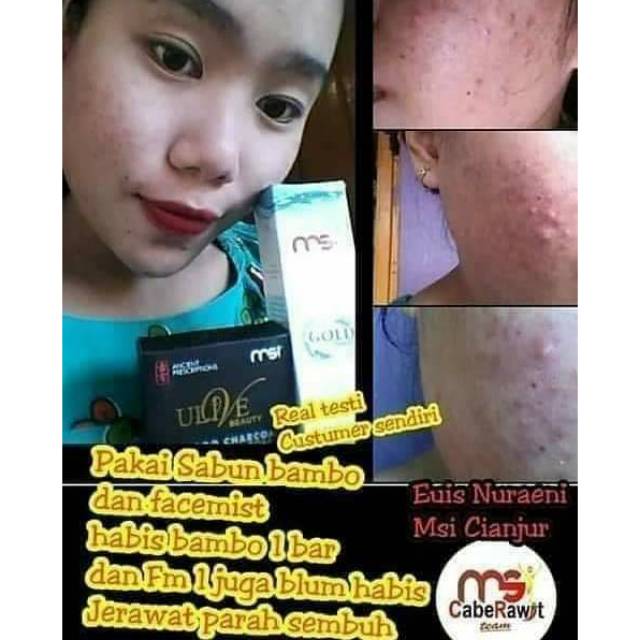 Paket Jerawat Ampuh😍