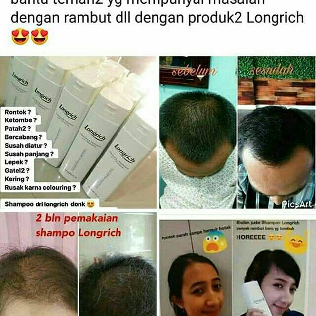 Shampo