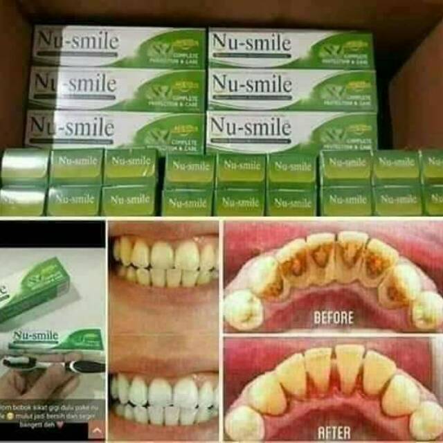 Nusmile