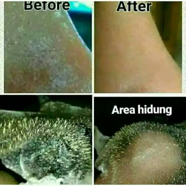 Masker Gelatin