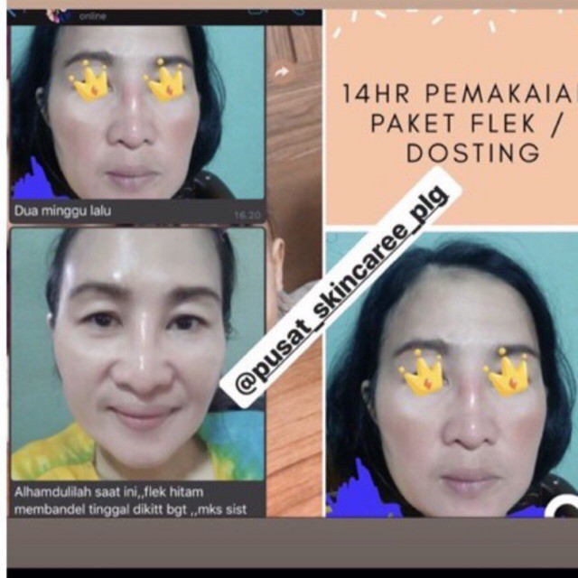paket super glowing