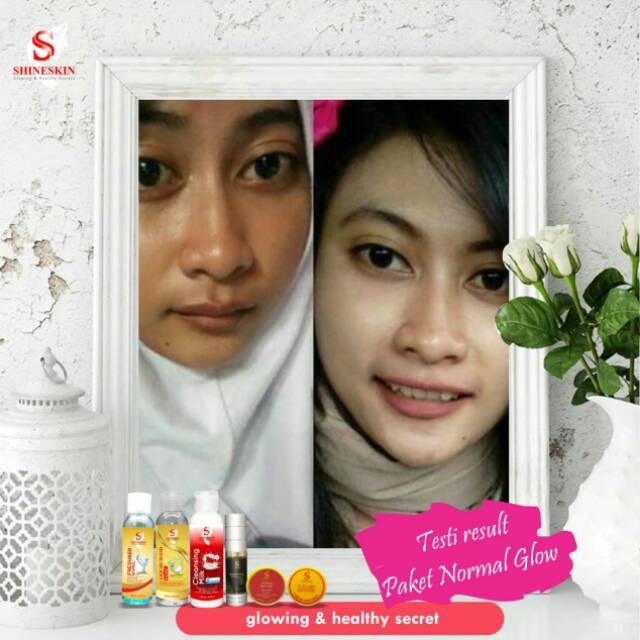 Paket  whitening normal and oily