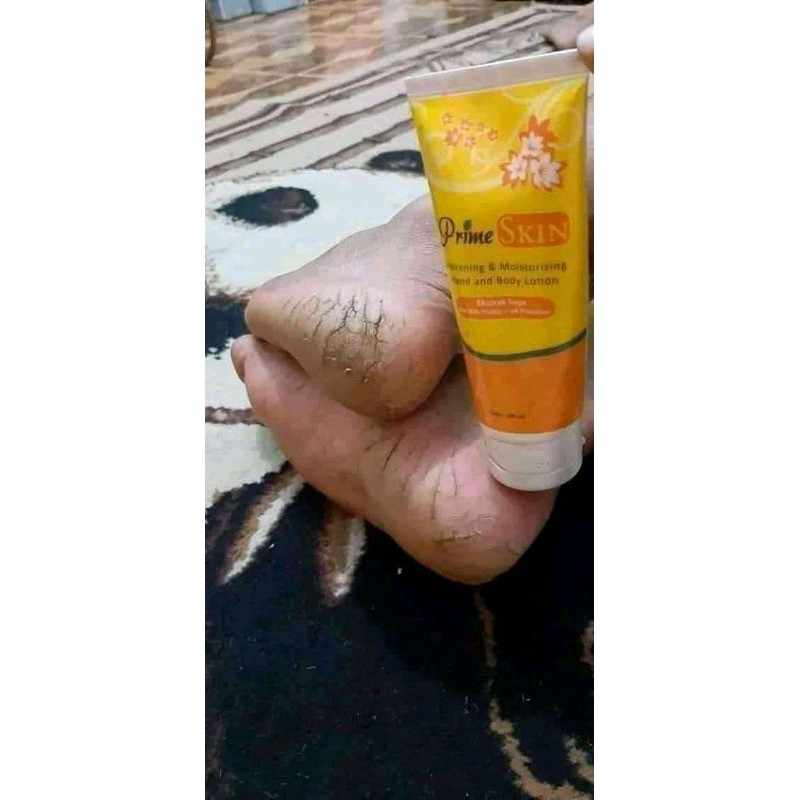 prime skin lotion HWI