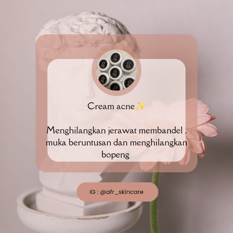 acne cream