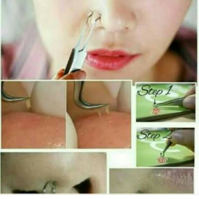 Pinset komedo
