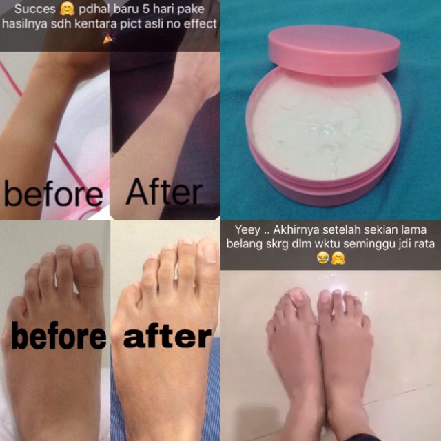 Skincare