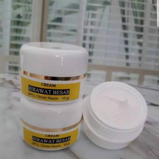 Crem malam  jerawat parah