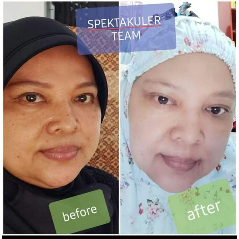 sabun edelwis