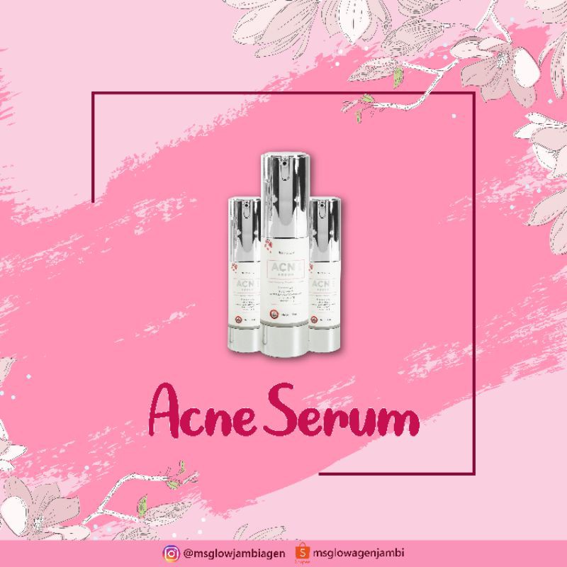 SERUM ACNE MS GLOW
