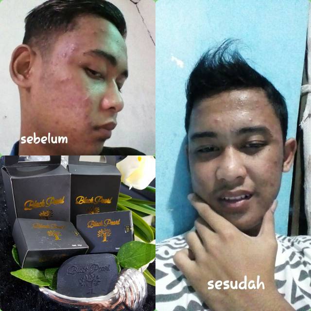 BLACKPEARL SABUN