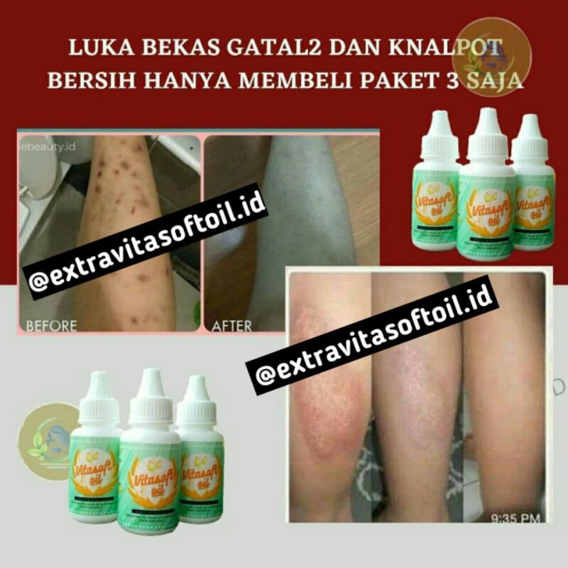 vitasoftoil + suplemen promo