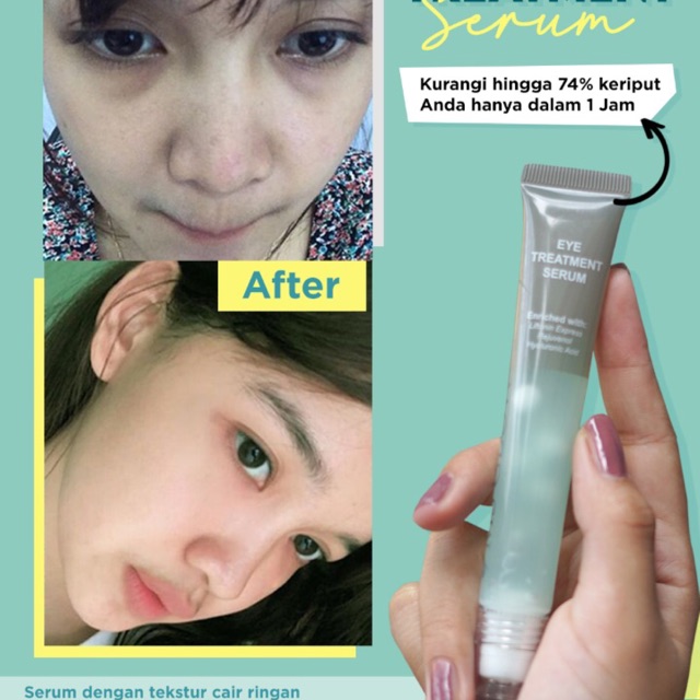 Eyes treatment serum