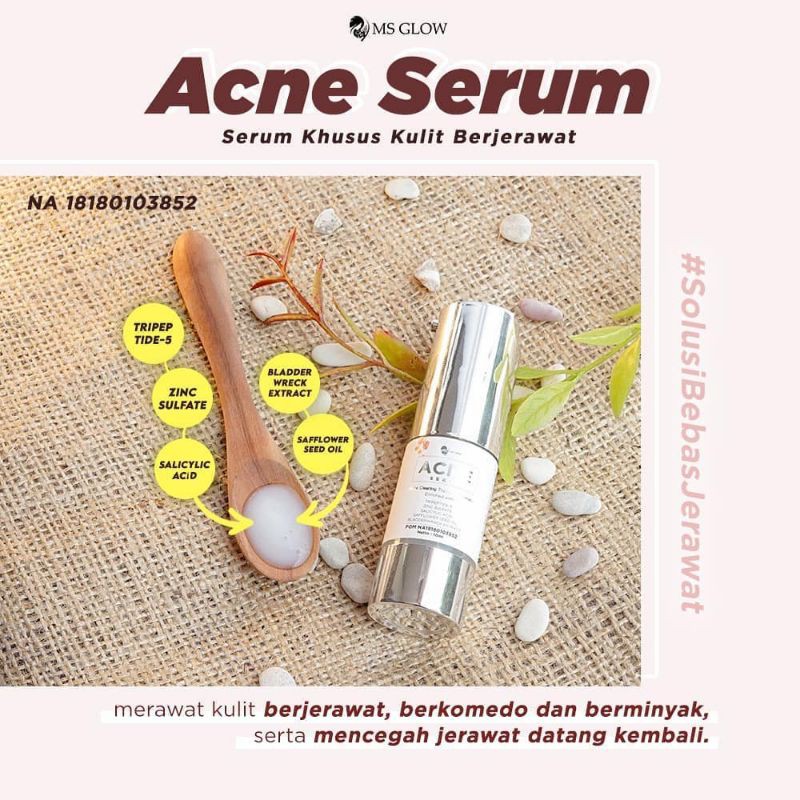 MS Glow Acne Serum