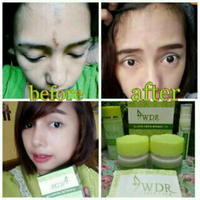 WDR Skincare
