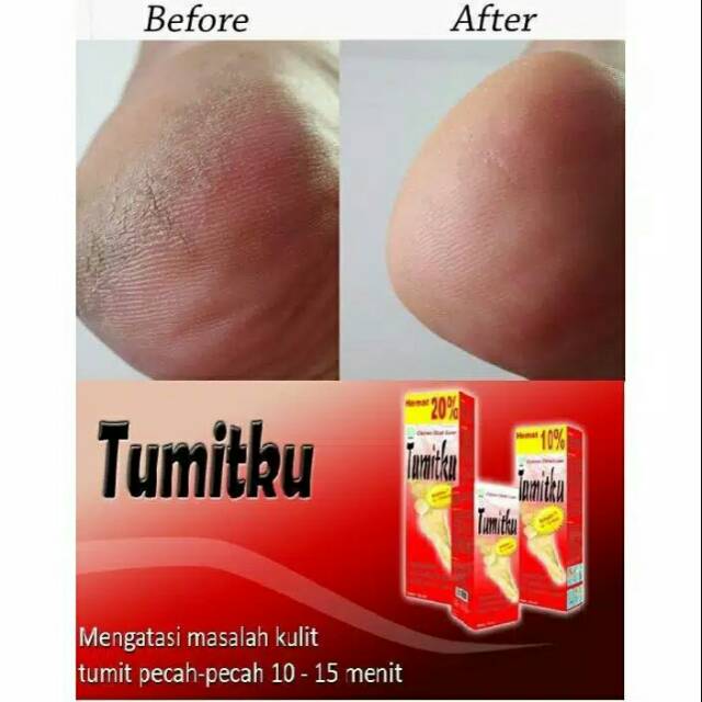 (anin_projectt) Tumitku original
