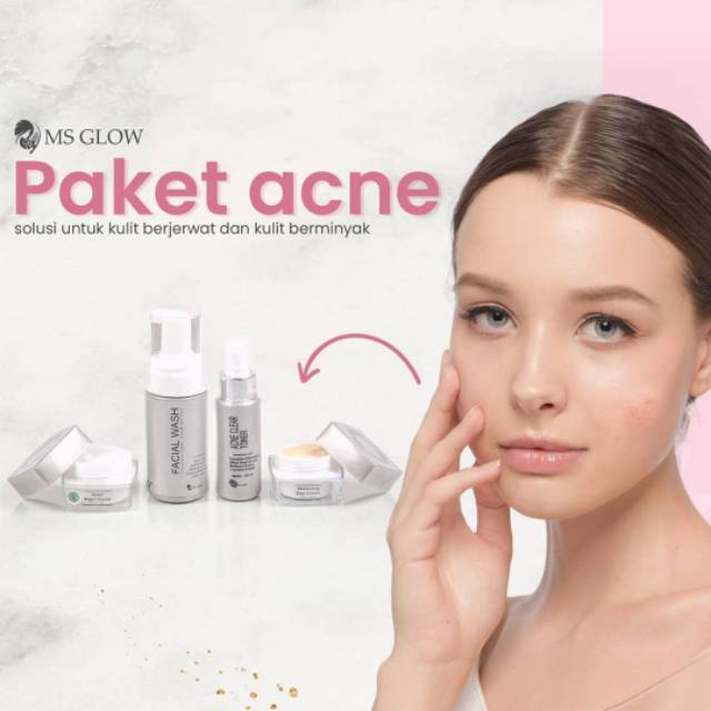 MS GLOW ACNE SERIES