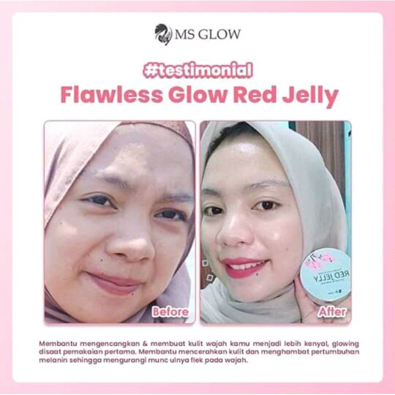 msglow