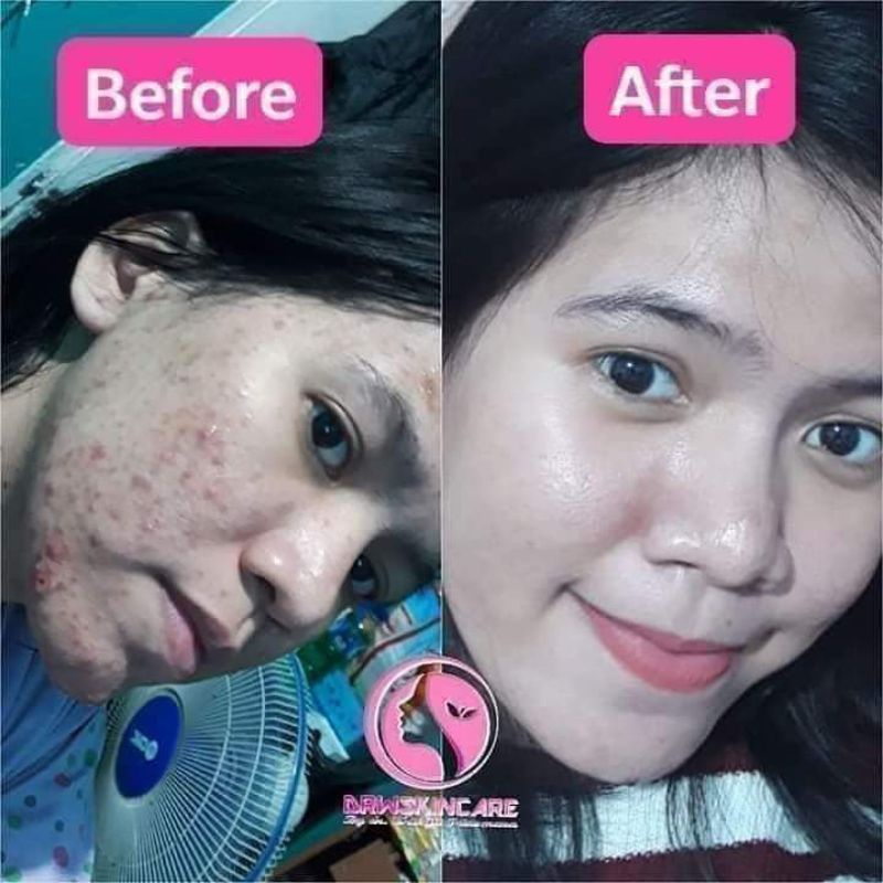 drw skincare