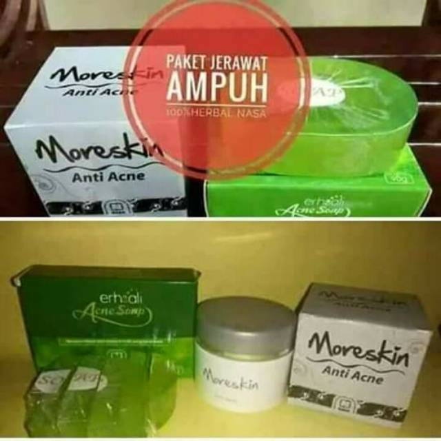 Paket Bebas Jerawat