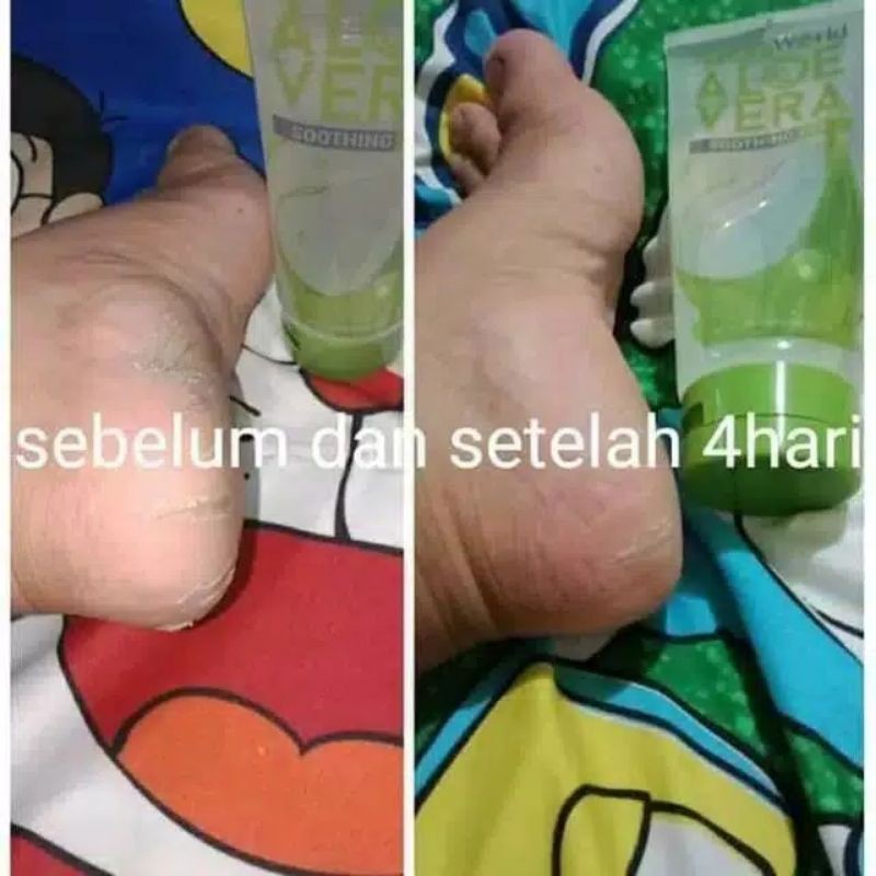 Natura Aloe Vera