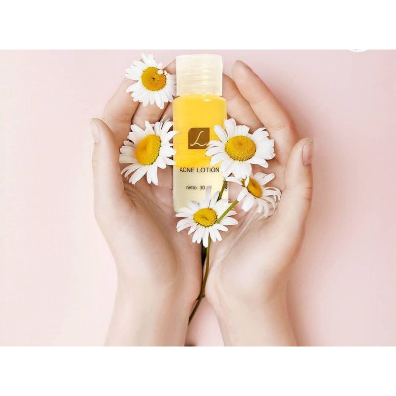 Acne Lotion