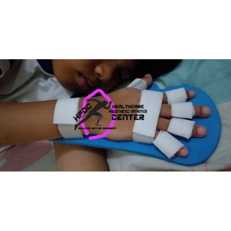 papan terapi pelurus jari custom