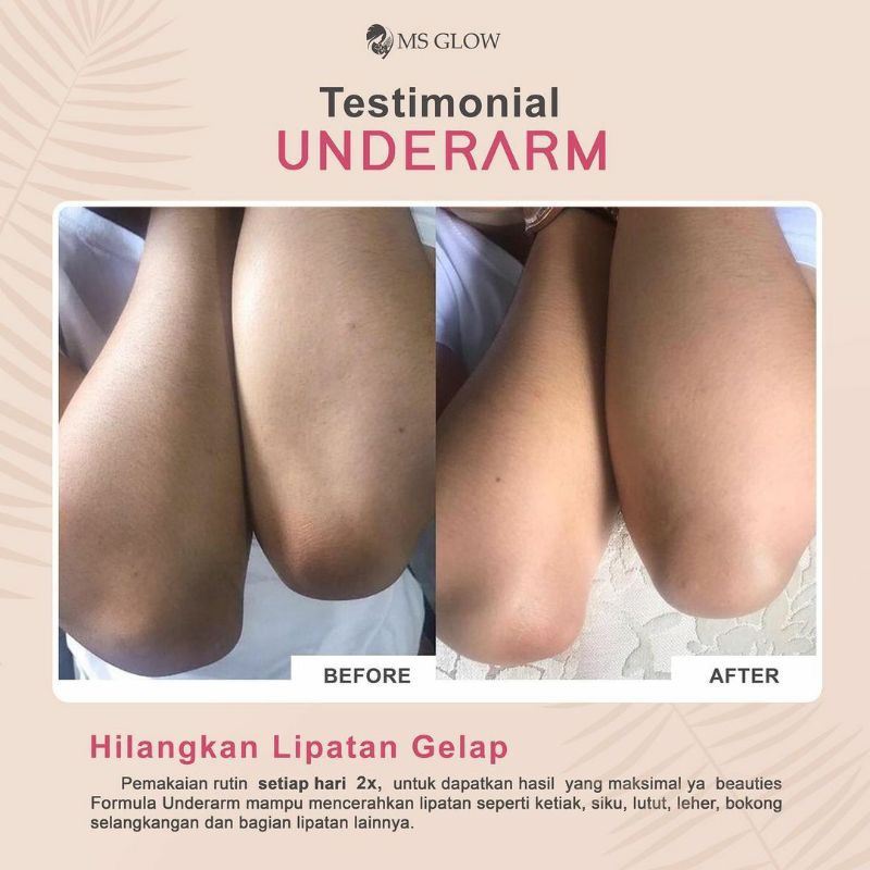 underarm