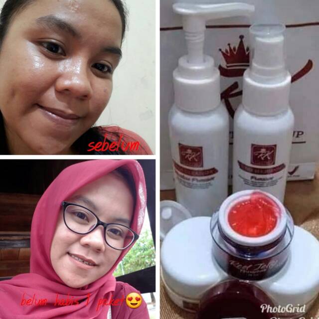 Rk glow+red jelly