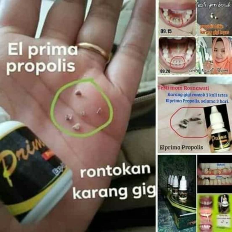EL PRIMA PROPOLIS