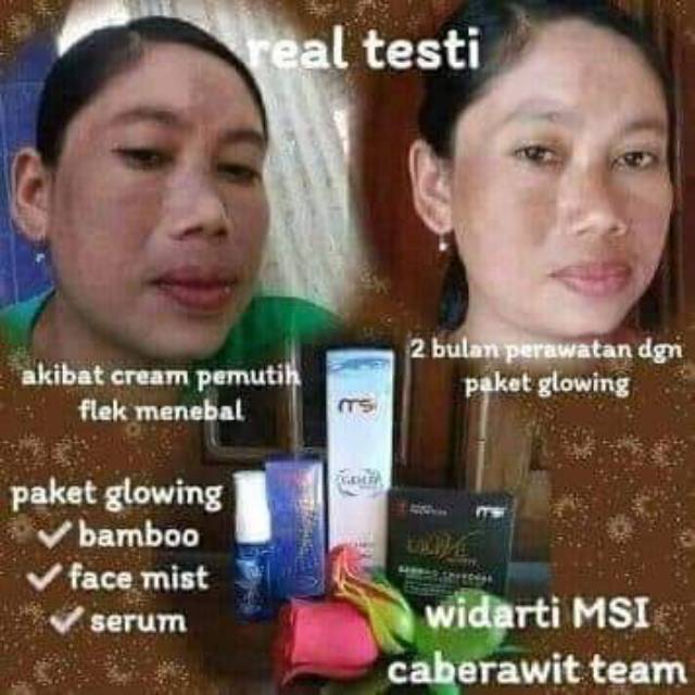 Paket flek