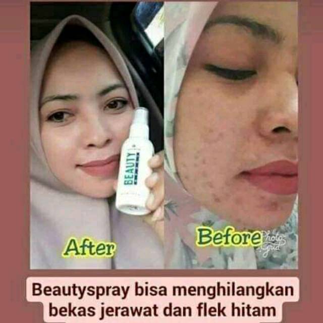 Natura beuaty spray