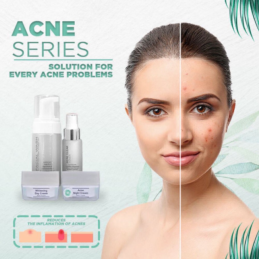 MS GLOW PAKET ACNE