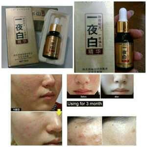 SERUM KOREA WHITENING
