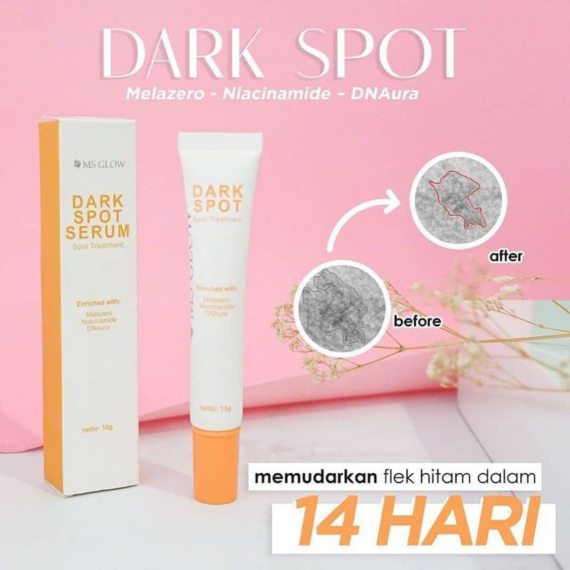 ms glow dark spot