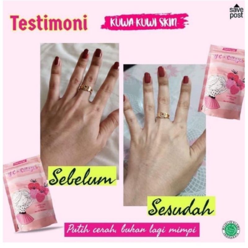 UC collagen