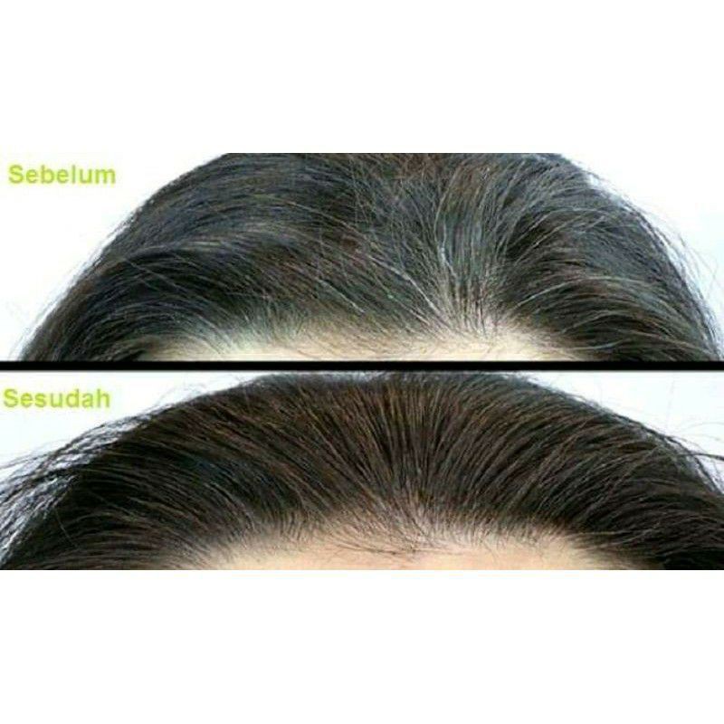 serum antiuban