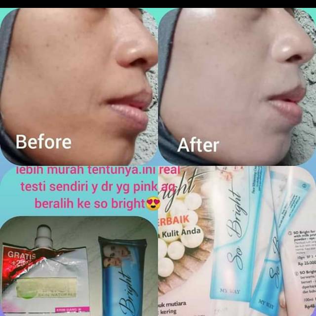 Cream pemutih so bright biru