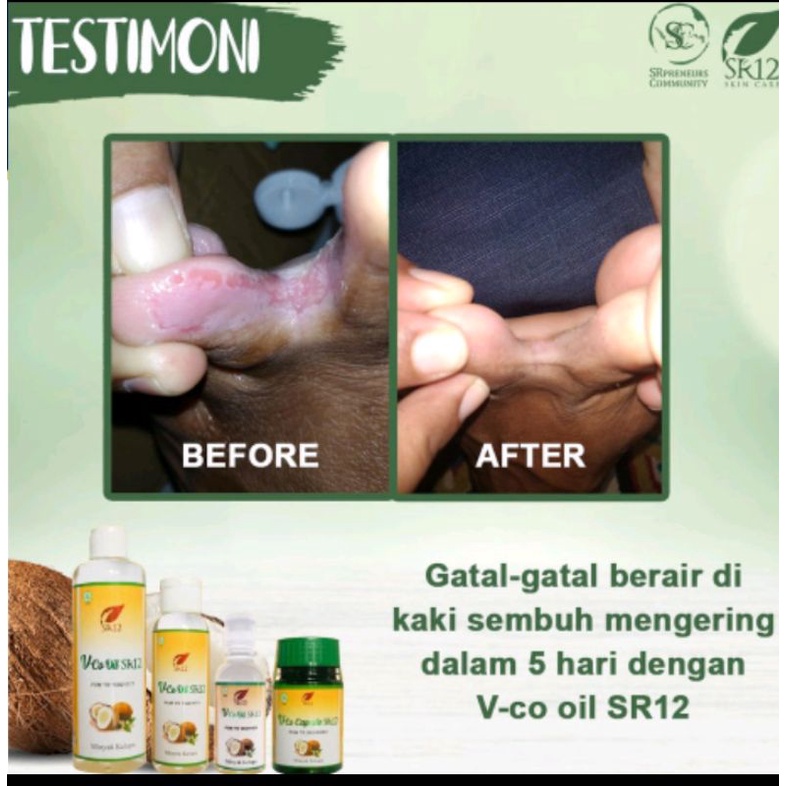 vco oil sr12