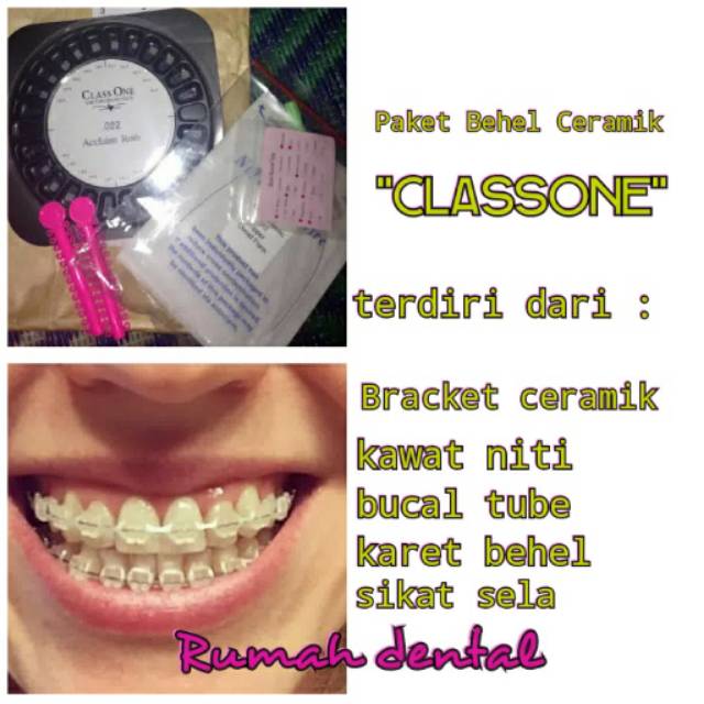 PROMO Behel Ceramik Classone