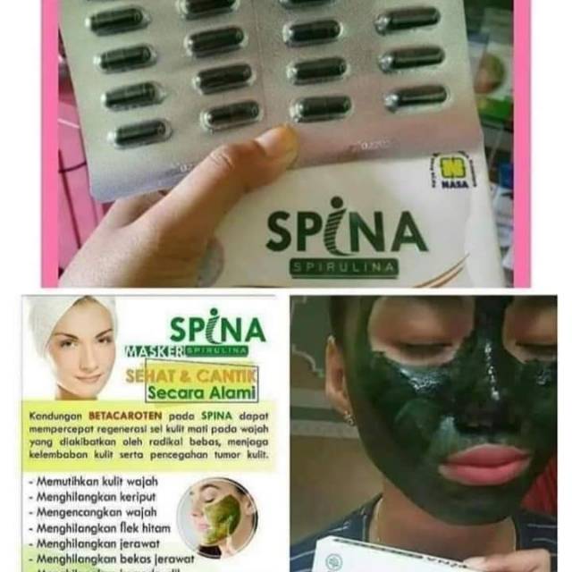 Spiriluna Nasa ( Spina )