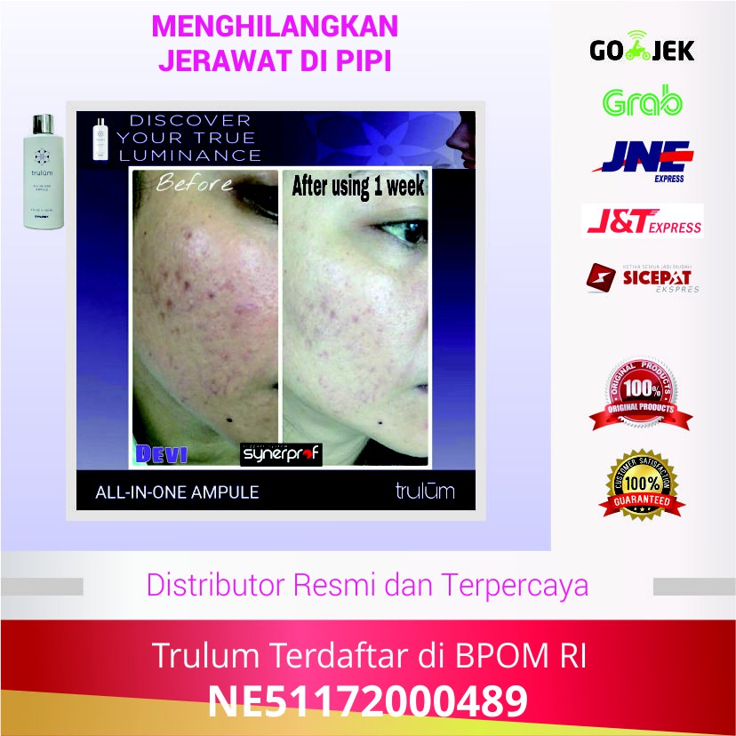 Trulum Spray Ampule untuk Jerawat 5ml